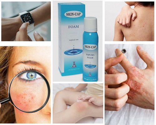 Súťaž o SKIN CAP Penu